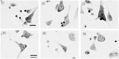 Intelligent diagnosis of major depression disease based on multi-layer brain network